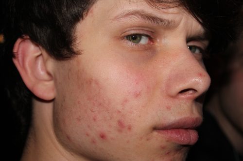 IMG 2632